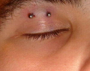 Eyelid Piercing