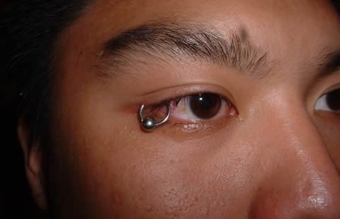 Check Out This Eye Piercing