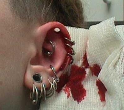 Injured Lobe Daith And Helix Piercing