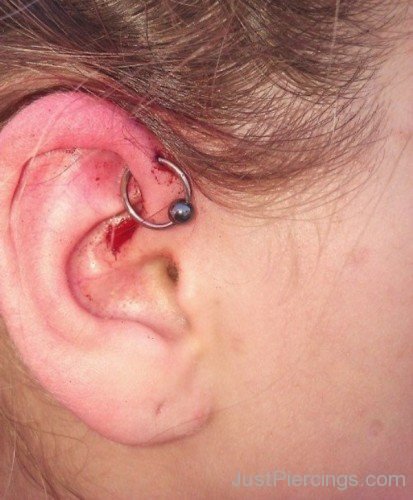 Anti Helix Ear Piercing. 89-JP1003