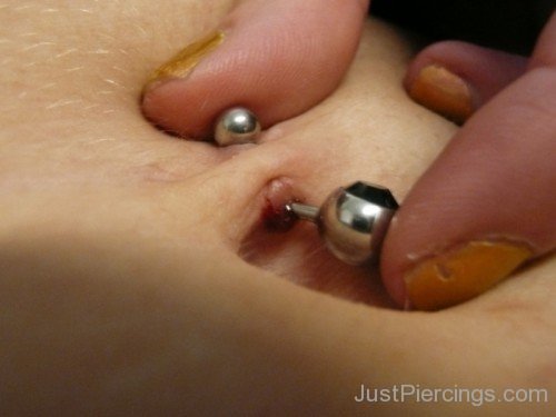 Infected Belly Button Piercing-JP1068