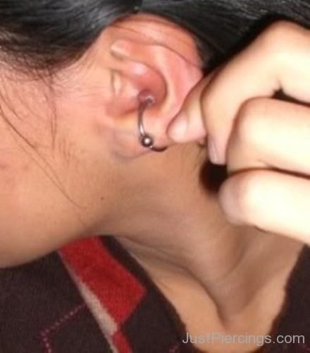 Infected Conch Piercing-JP1183