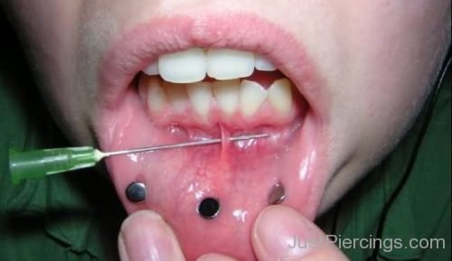Dermals Lip And Frowny Piercing With Cannula-JP1022